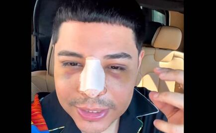 Eduin Caz, de Grupo Firme reaparece hinchado y convaleciente con nueva canción de Shakira