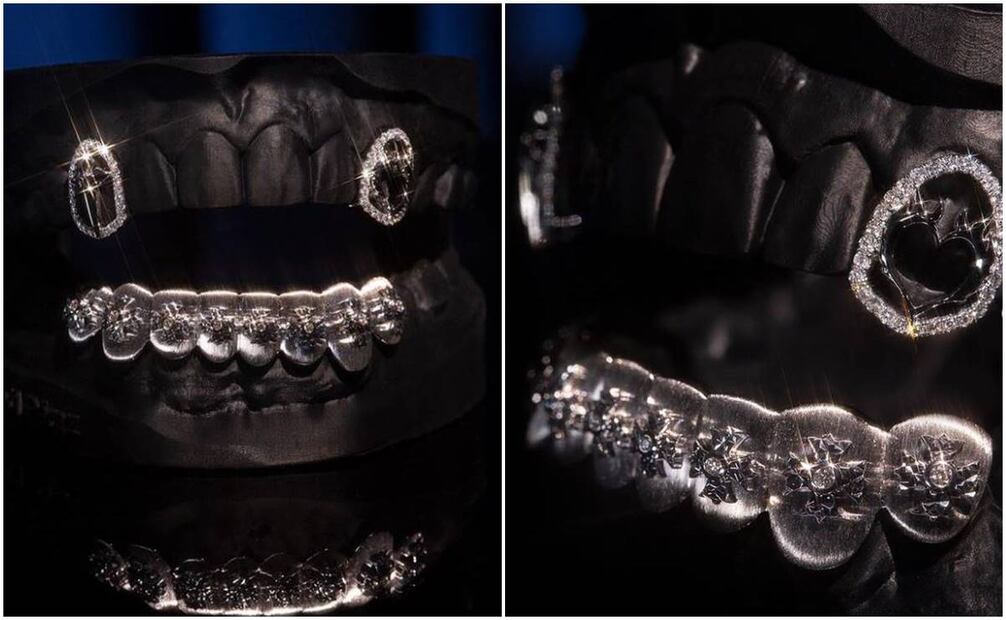 Christian Nodal estrena dentadura de lujo.