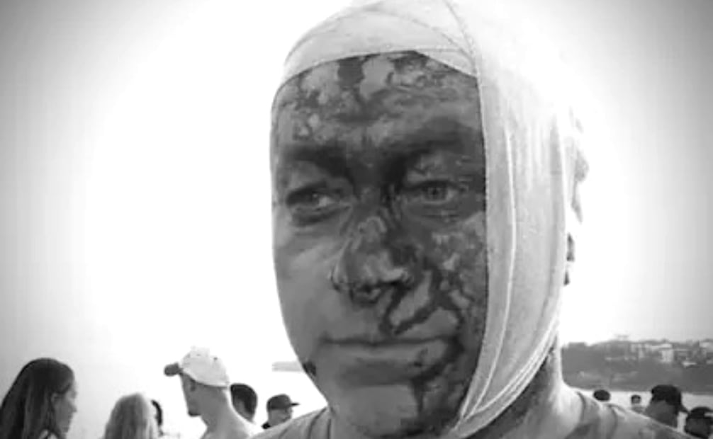 Sobreviviente de ataque de Hamas resulta herido durante Janucá en Australia. (14/10/25) Foto: Redes sociales