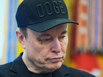 El ojo morado de Musk; "adelante, golpéame en la cara", le dijo a su hijo