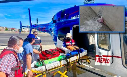 Barda cae sobre 2 niños en primaria de Hidalgo; resultan heridos de gravedad 
