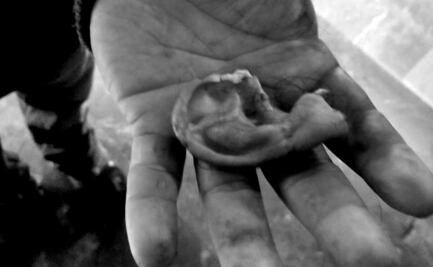 Acoso a mujer, lo que desató riña en Metro Xola donde arrancaron oreja a usuario