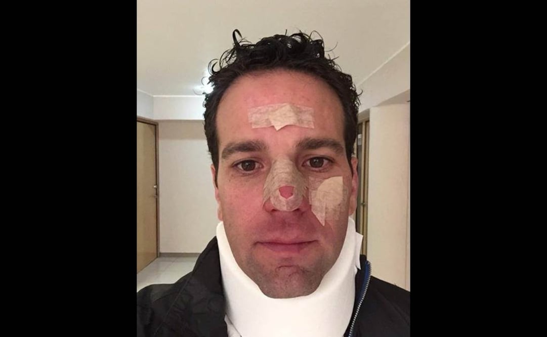 Carlos Loret sufre accidente jugando beisbol