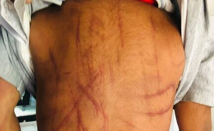 Rescatan a niño de tres años en Valle de Chalco, era golpeado por su madre y su pareja