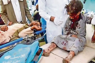 Mueren 29 niños en ataque en Yemen