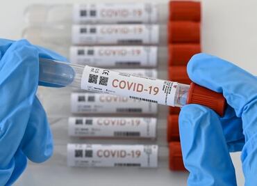 Reportan brote de Covid-19 en el Gobierno de Yucatán y el Ayuntamiento de Mérida