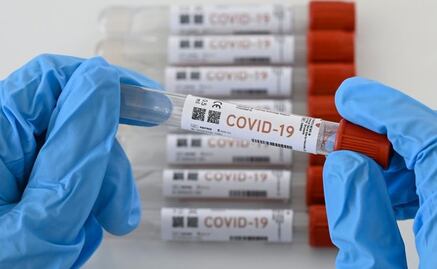 Reportan brote de Covid-19 en el Gobierno de Yucatán y el Ayuntamiento de Mérida