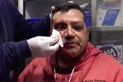 Periodistas de Reforma y TV Azteca denunciaron agresión de policías en la Doctores