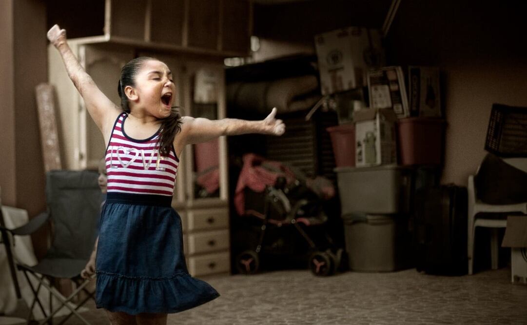 Danna Paola Villarreal Montaño, la niña más pequeña que resultó con graves quemaduras en su cuerpo en el incendio de la Guardería ABC, en junio del 2009, cumplió XV Años. Foto: Luis Cortés / Archivo EL UNIVERSAL