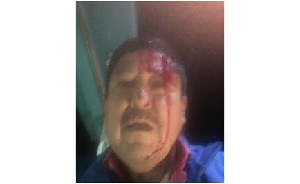 Agreden a "batazos" a periodista en Baja California Sur
