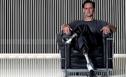 Prótesis robóticas e implantes cerebrales frenan la discapacidad