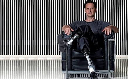 Prótesis robóticas e implantes cerebrales frenan la discapacidad