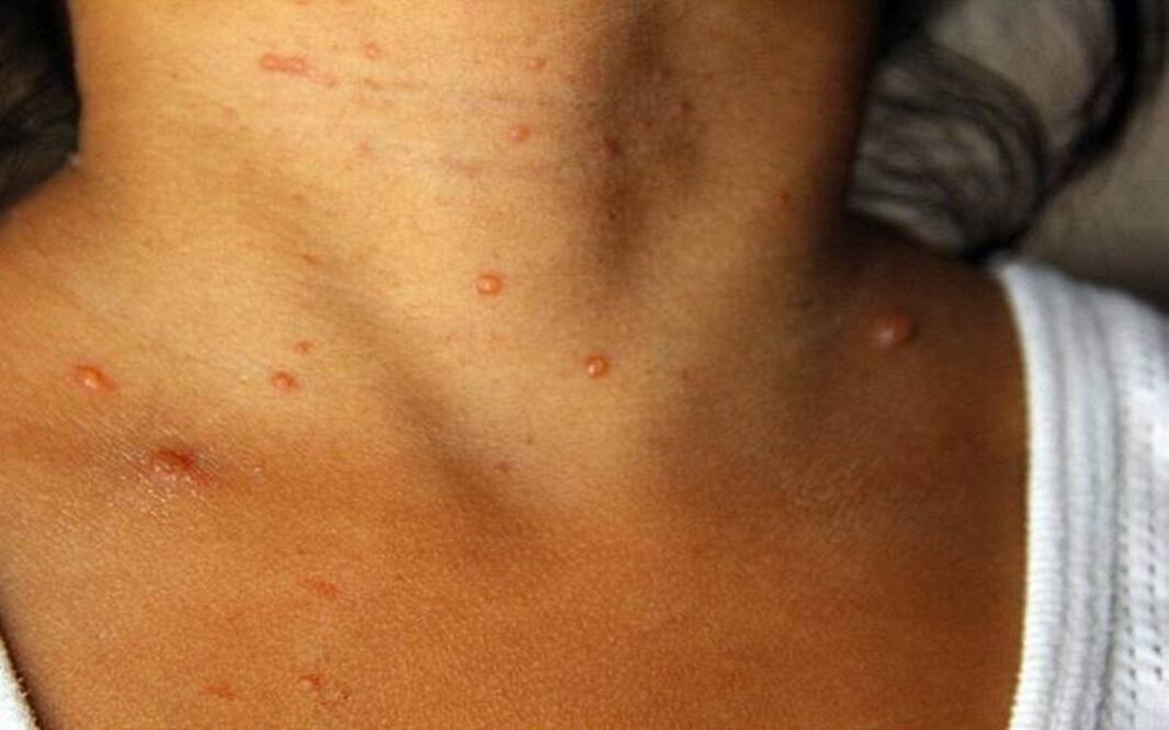 Foto: Cuauhtémoc Moreno