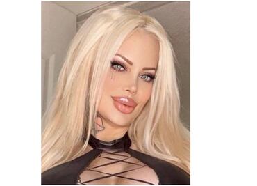 Por abusar del bótox, Sabrina Sabrok pierde parcialmente la movilidad de su rostro
