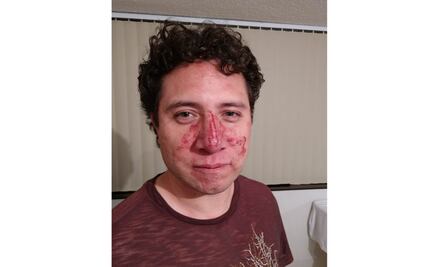 Agreden a vocero de los damnificados en el multifamiliar de Tlalpan