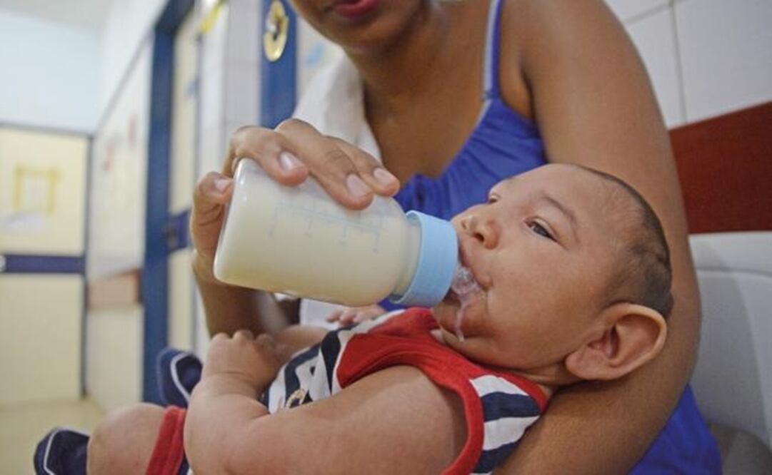 Zika has been correlated to some microcephaly cases, like this one in Brazil. (Photo: AP)