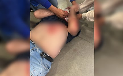 Trabajador de Walmart resulta herido tras agresión con arma punzo cortante en Portal Cuautitlán; intentó atrapar a farderos
