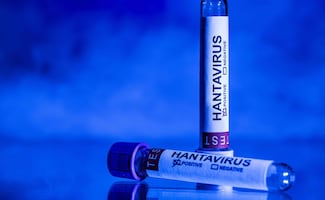 OMS eleva a 11 los casos positivos por hantavirus; "el trabajo no ha terminado"