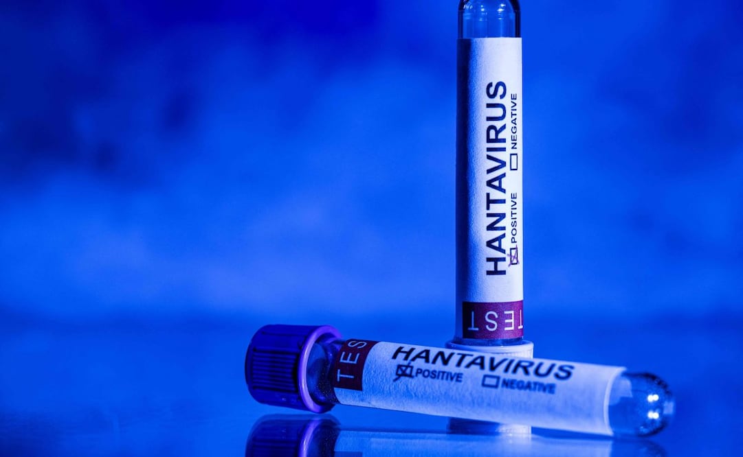 This photo taken in Paris on May 11, 2026 shows vials bearing the name of "hantivirus". A deadly hantavirus outbreak on a cruise ship has spurred global concern over the potential spread of the virus among and from ship evacuees as they head back to their home countries. Here are the World Health Organization's main recommendations to limit the transmission risks and to better protect those exposed to the rare virus, which usually spreads among rodents, and for which there is no vaccine or treatment. Foto: AFP