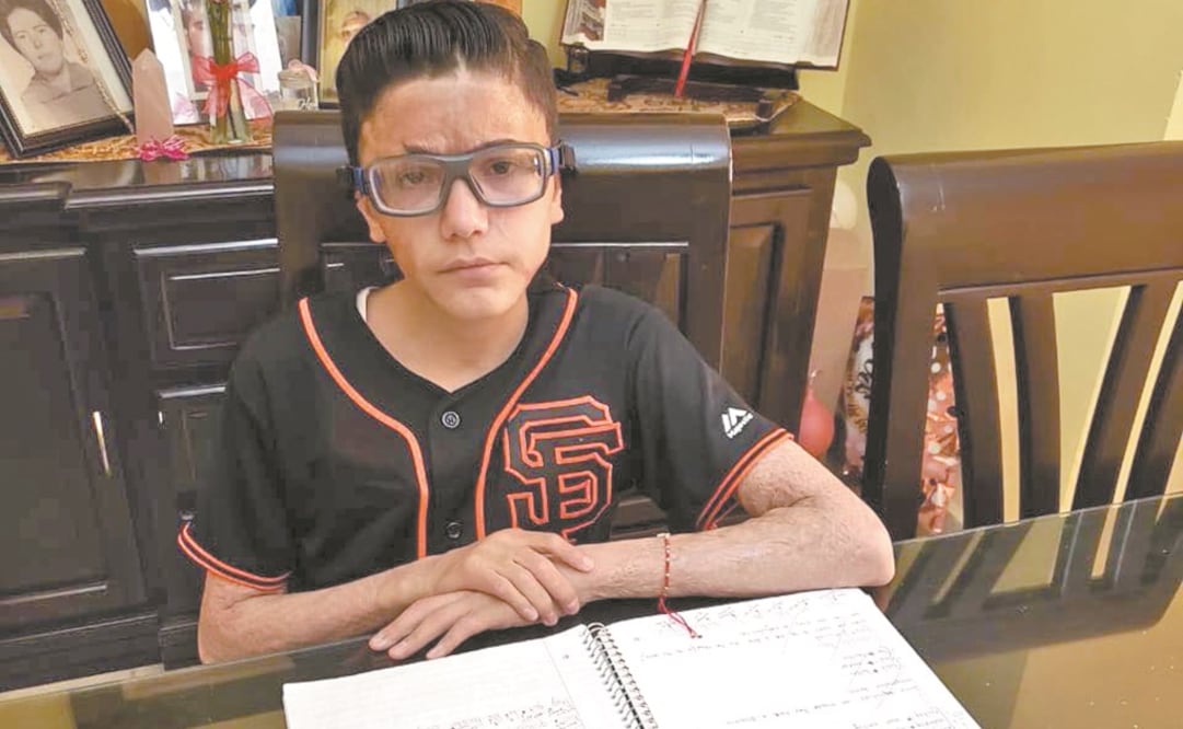 A los tres años, Héctor sufrió quemaduras de segundo y tercer grado en 60% de su cuerpo, tras el incendio de la Guardería ABC.