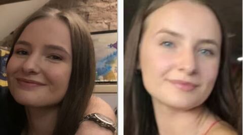 "Intentó arrancarme la cara": sentencian a hombre que atacó a una mujer a mordidas en Reino Unido