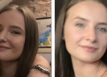 "Intentó arrancarme la cara": sentencian a hombre que atacó a una mujer a mordidas en Reino Unido