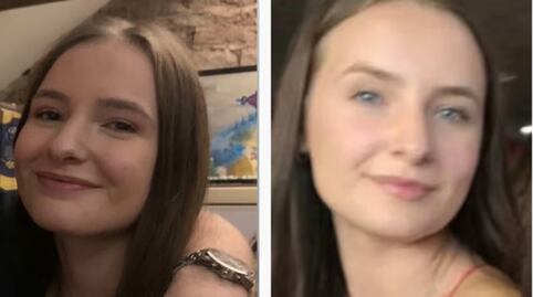 "Intentó arrancarme la cara": sentencian a hombre que atacó a una mujer a mordidas en Reino Unido