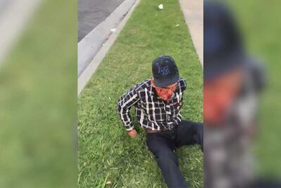 Golpean con un ladrillo a mexicano de 92 años; "vete a tu país", le exigen en EU