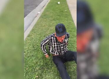 Golpean con un ladrillo a mexicano de 92 años; "vete a tu país", le exigen en EU