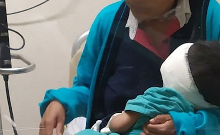 Atienden a menor de Oaxaca con riesgo de perder un ojo