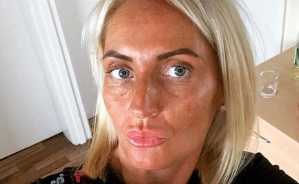 Falla su bronceado y queda con piel verde: se vuelve viral