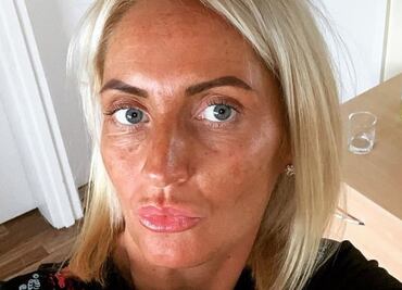 Falla su bronceado y queda con piel verde: se vuelve viral