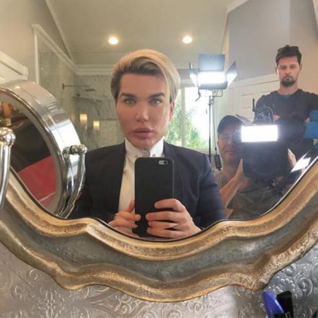 "Ken Humano" desafía la estética y se quema la piel del rostro