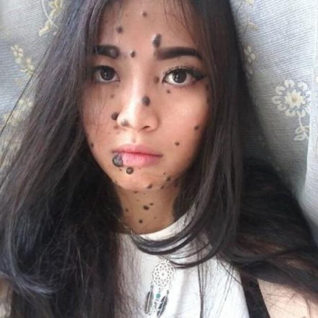 La modelo con lunares y verrugas que rompe esquemas