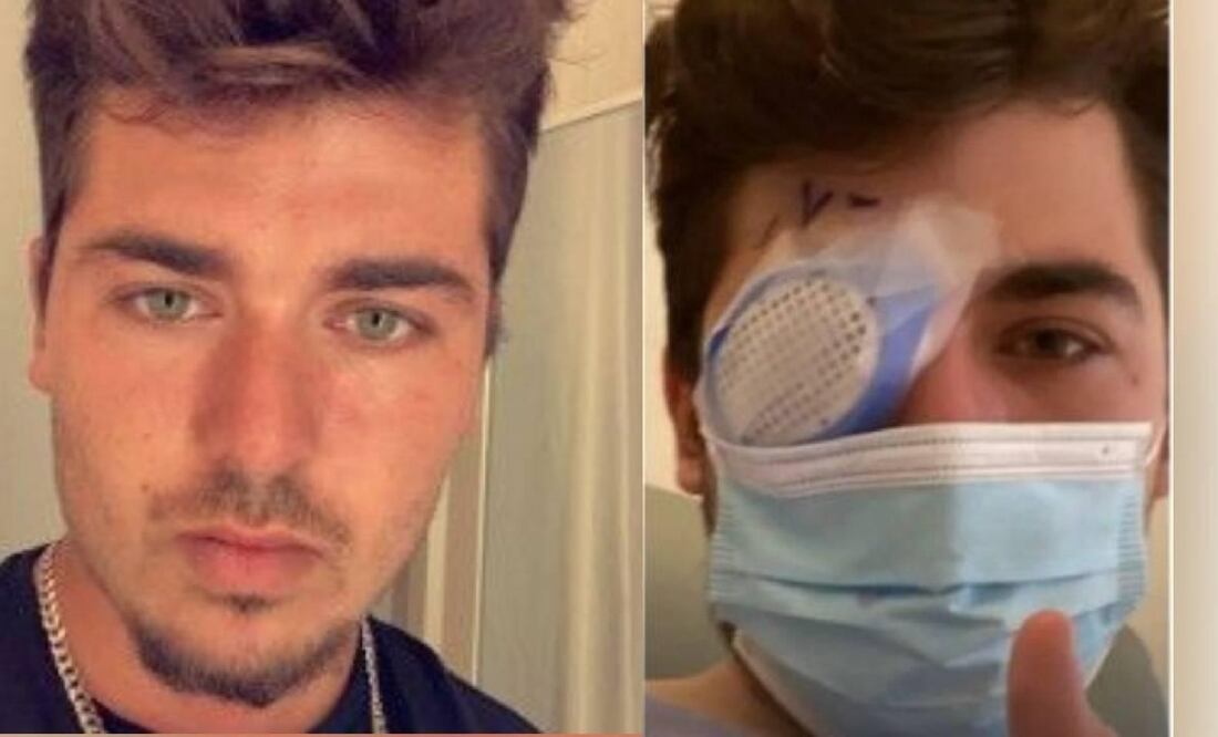 El hombre esperar recuperar su visión. Foto: TikTok: @mikekrumholz13