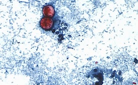 EU reporta 2 muertes por cyclospora en Michigan; van más de 4 mil casos confirmados
