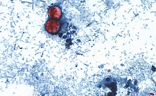 EU reporta 2 muertes por cyclospora en Michigan; van más de 4 mil casos confirmados