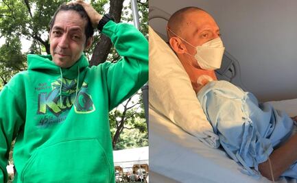 "El Zopi", cantante de Los Rastrillos, hospitalizado después de una recaída en su batalla contra el cáncer