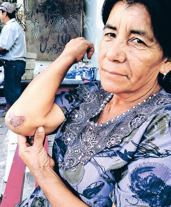 Doña Elena no fue internada, pero su nieto de 7 sufrió fracturas en ambas piernas y la de 6 se abrió la cabeza; le dieron nueve puntadas (HILDA FERNÁNDEZ. EL UNIVERSAL)