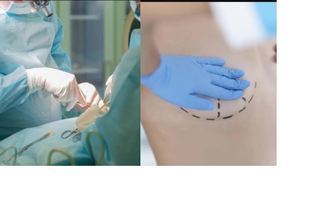 Una mujer recibió un disparo. Sus prótesis de silicona le salvaron la vida. FOTO: ESPECIAL