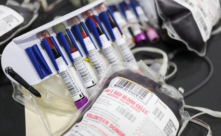 Por Covid-19, flexibilizan en EU reglas que impedían a homosexuales donar sangre