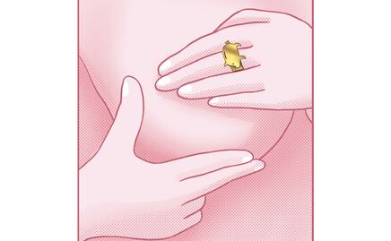 Costo del cáncer de mama; prevenir protege tu salud y bolsillo