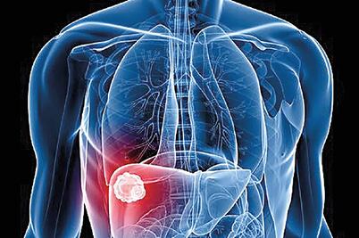 Opción para reparar vías biliares y uretra dañadas