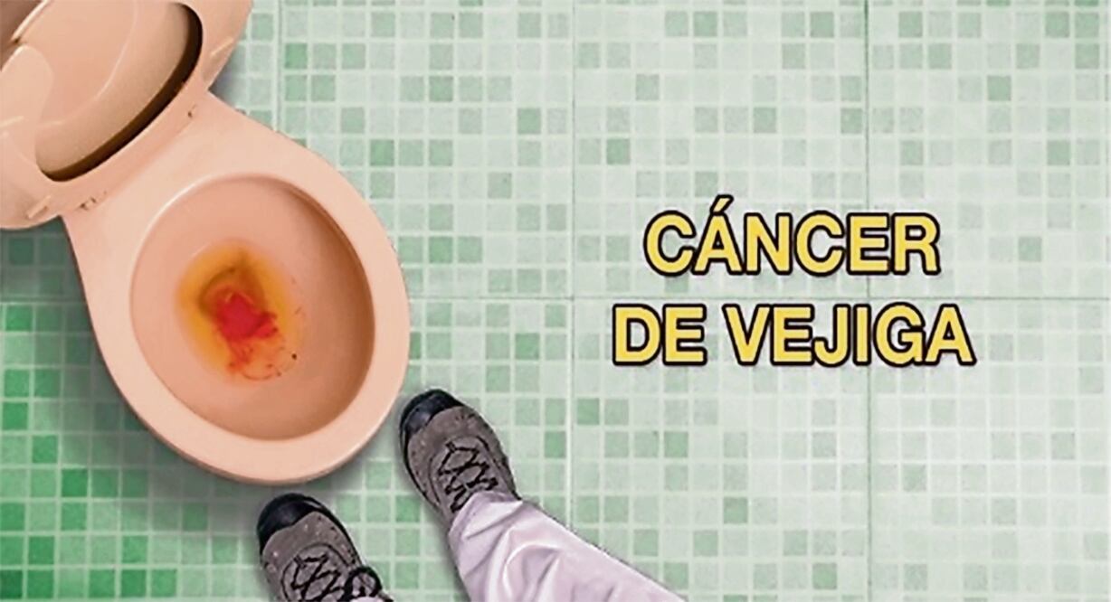 Con una taza de baño con sangre se pretende advertir que el tabaquismo causa más de la mitad de los cánceres de vejiga y que es la decimotercera causa de muerte por este mal.Foto Especial