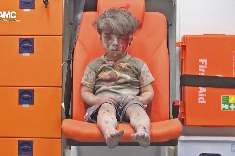 La imagen de Omran, tras ser rescatado de los restos de su casa destruida por un bombardeo en Aleppo, se ha convertido en una de las más representativas del conflicto armado en Siria, que dura ya cinco años (XINHUA)