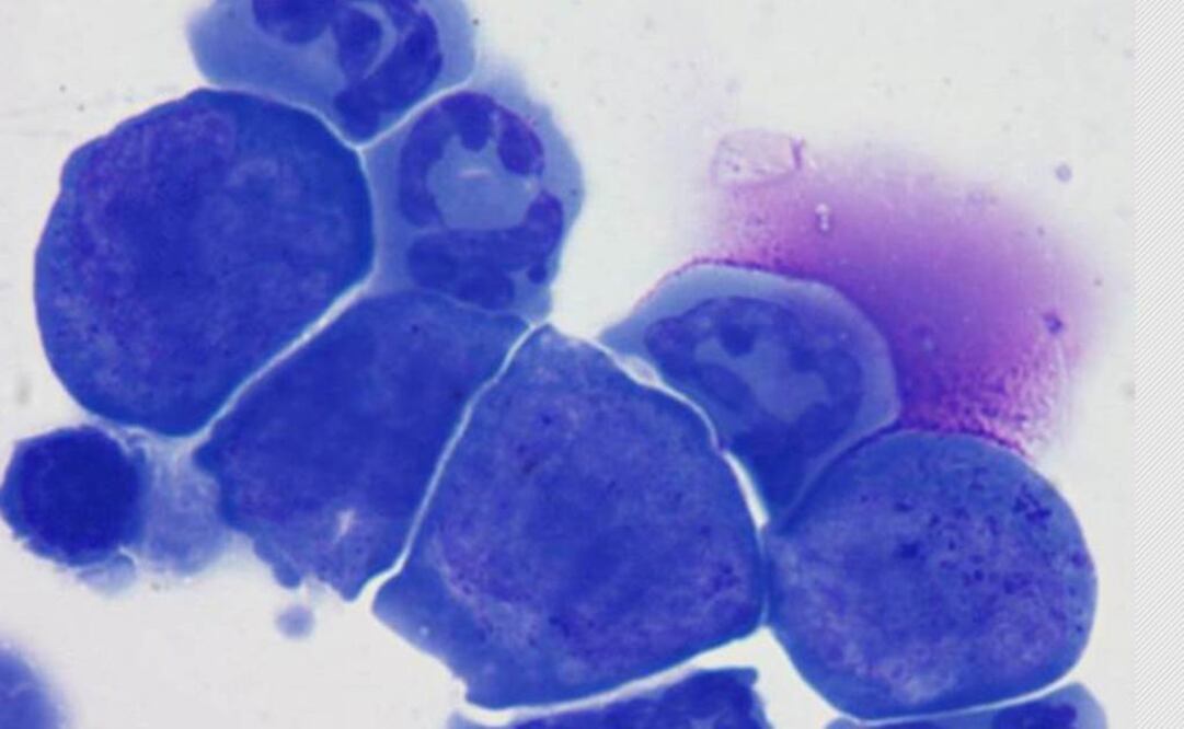 La capacidad de combinar diagnóstico y terapia no es exclusiva de los nanotubos y está siendo explorada con otros nanovehículos. Foto: Archivo