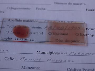 Detectan 2 casos de malaria entre migrantes en Centro de Movilidad de San Sebastián Tutla, Oaxaca