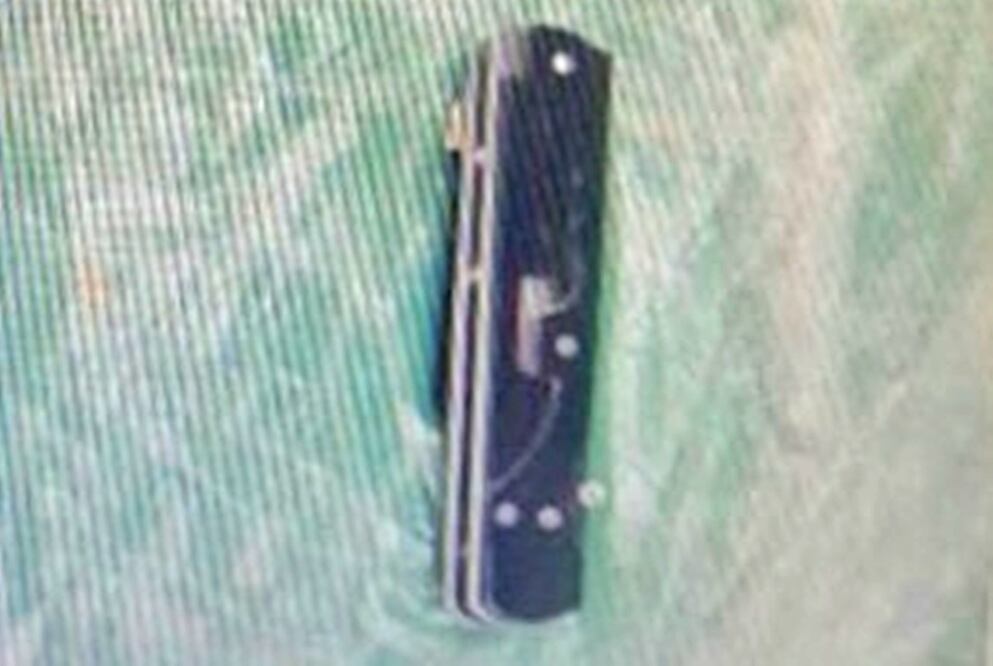 Al lugar llegaron paramédicos de Protección Civil, quienes certificaron que las lesiones recibidas por el menor, no eran graves. Foto: Especial