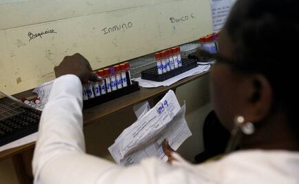 Perú reporta primer caso de zika por transmisión sexual