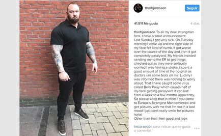 Actor de "Game of Thrones" revela que padece parálisis facial 